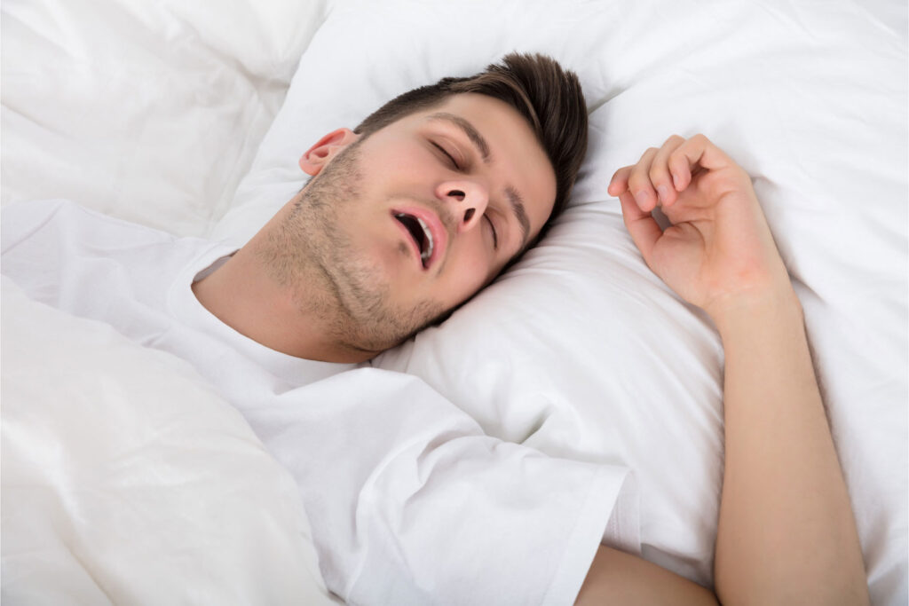 patient wearing sleep apnea oral appliance at night