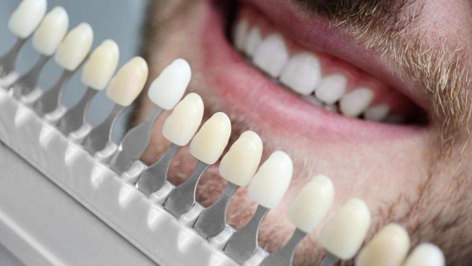 Dental Veneers Carlsbad