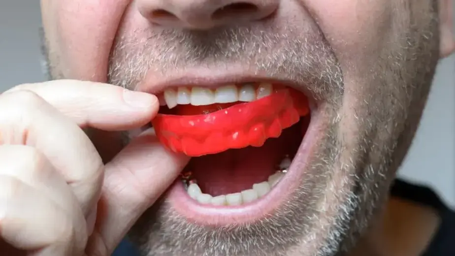 Types of Mouthguards