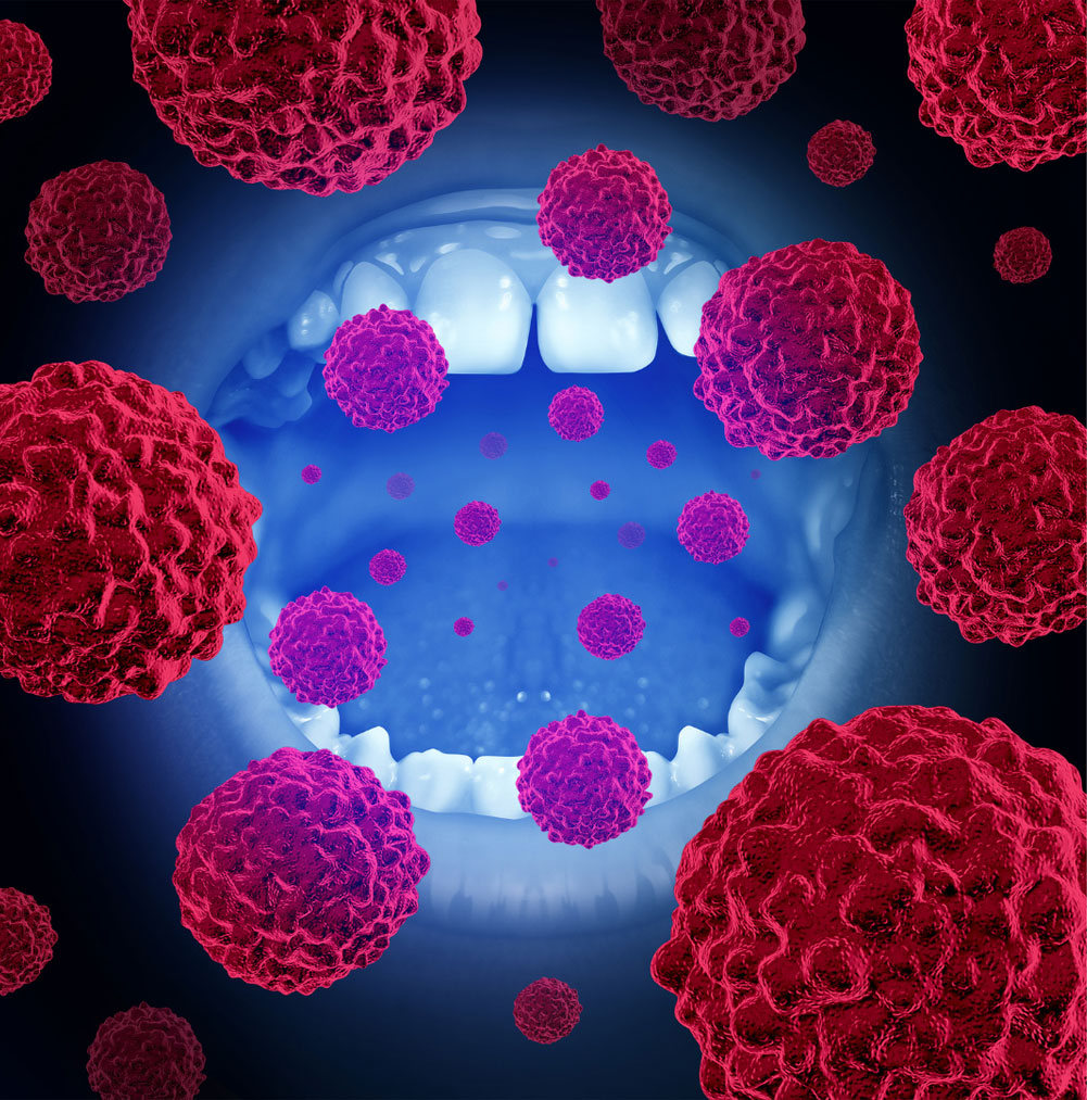 oral bacteria and respiratory infection risk explanation