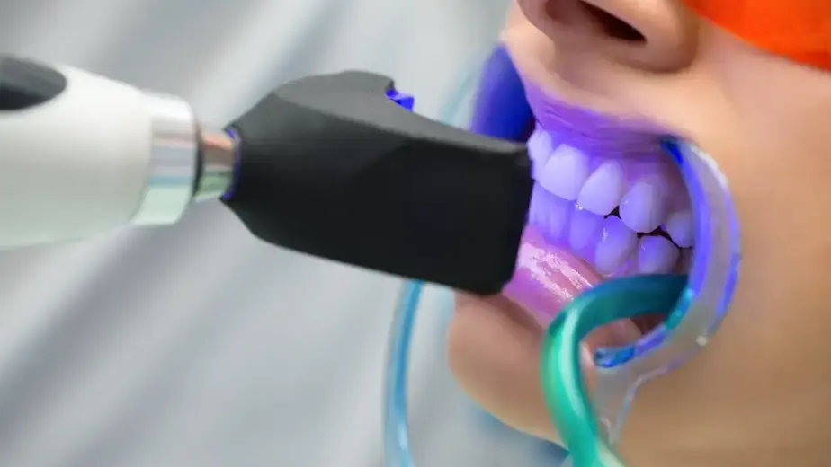 zoom whitening