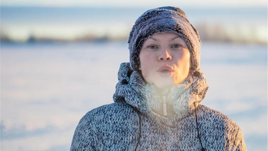 winter dental problems dry mouth and chapped lips
