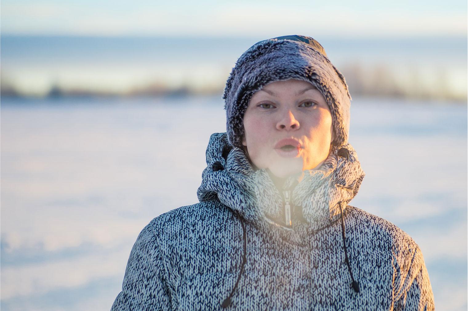 winter dental problems dry mouth and chapped lips