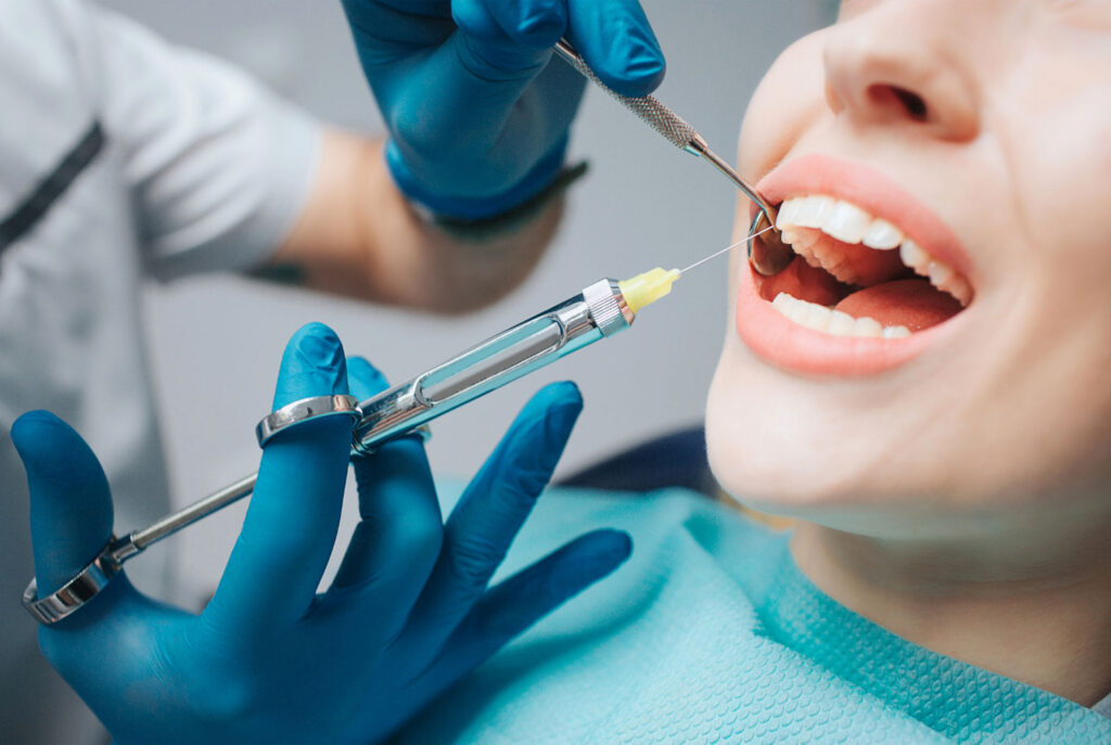 root canal treatment Carlsbad with local anesthesia
