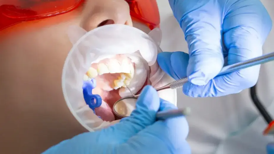 root canal treatment