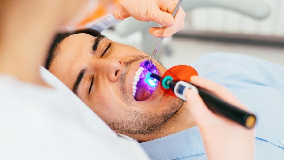dental sealants applied to molars in Carlsbad