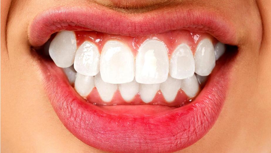 tooth with bruxism