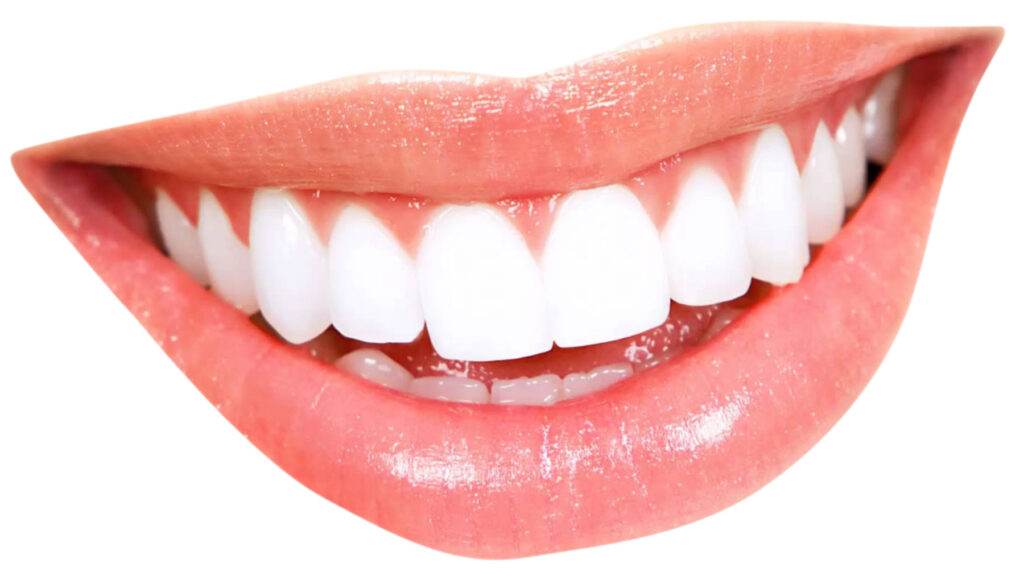 patient smiling after professional whitening treatment