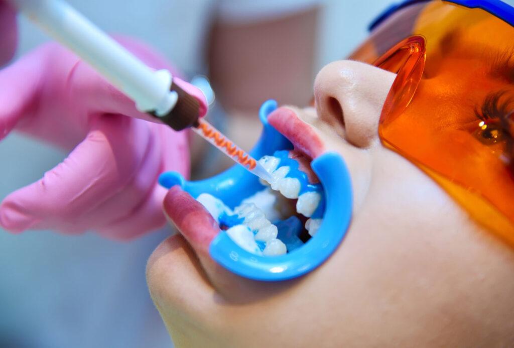 dental procedures for a brighter smile options overview