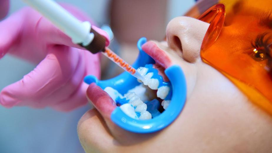 dental procedures for a brighter smile options overview