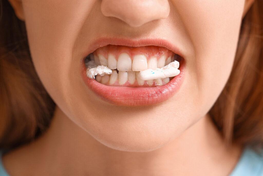 bruxism evaluation appointment in Carlsbad