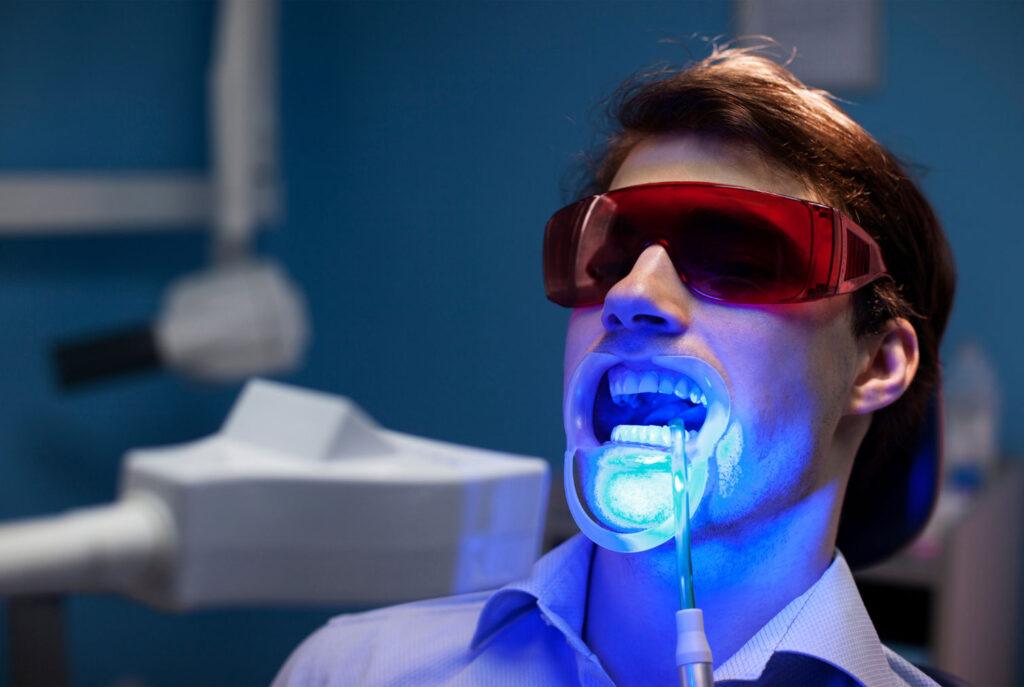 teeth whitening in office procedure