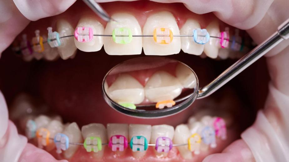 braces kid-friendly soft ideas