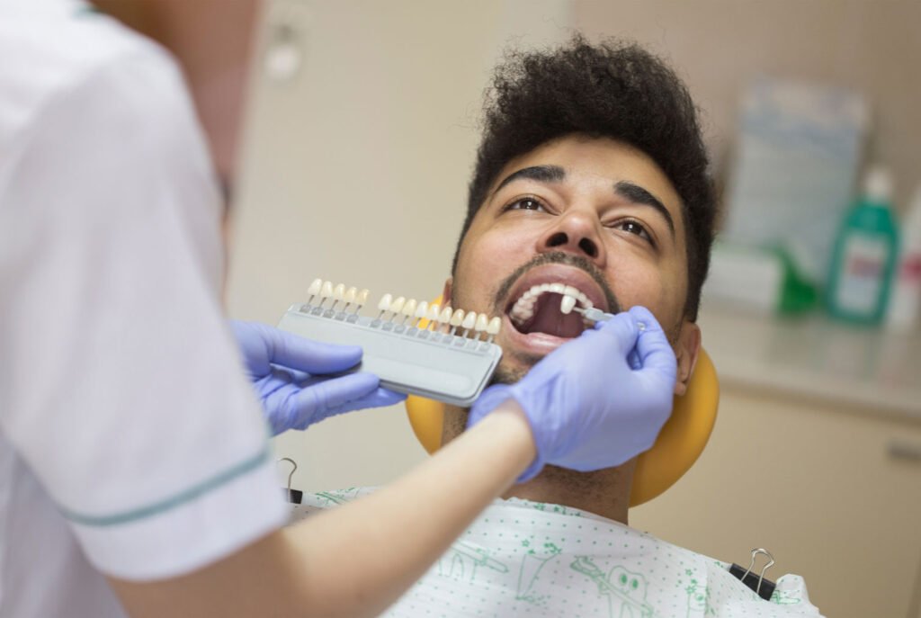 porcelain veneers alternative when whitening isn’t ideal