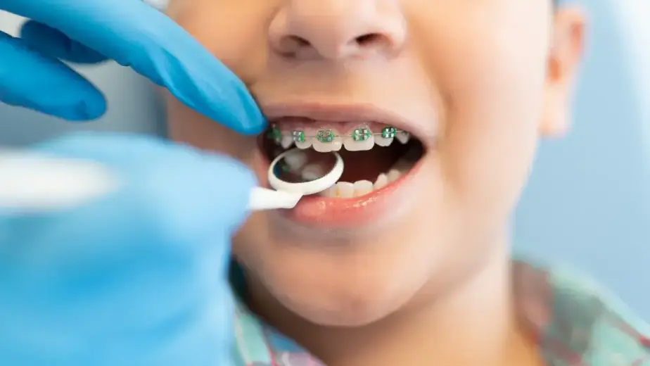 clean braces