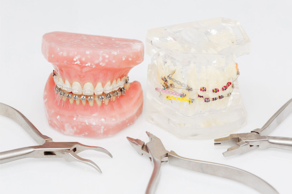 orthodontic consultation for braces and bite correction