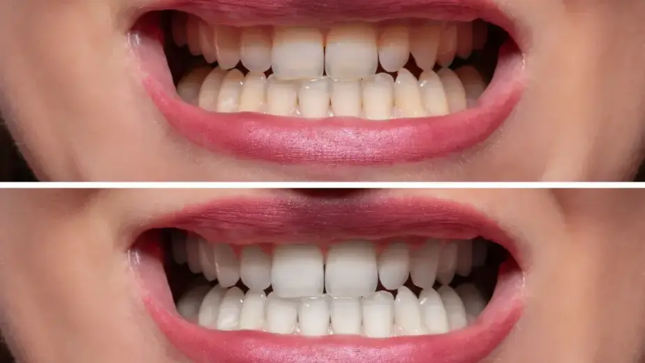 What Is Cosmetic Dentistry?