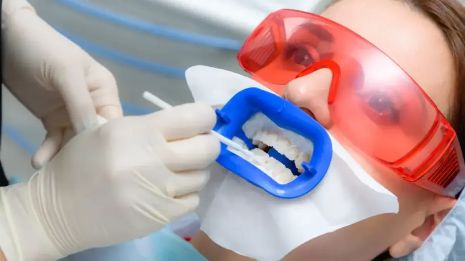 teeth whitening in Carlsbad