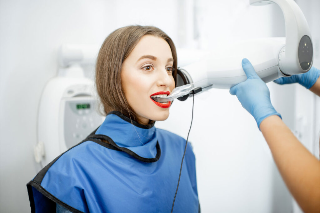 bitewing dental x-rays showing tooth decay under fillings