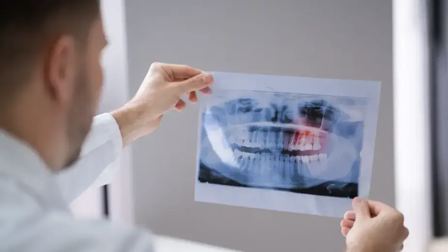 What You Need To Know About Dental X-Rays