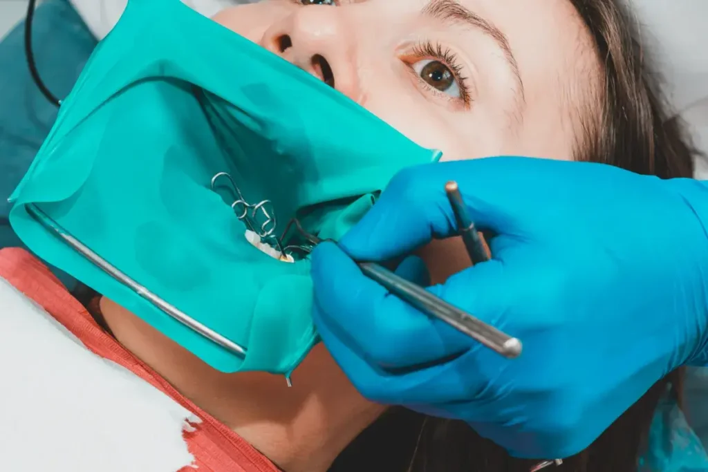 post root canal tips