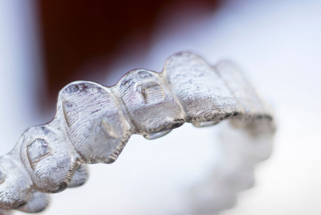 Tooth-colored attachments on teeth designed to help aligners grip for precise movements

