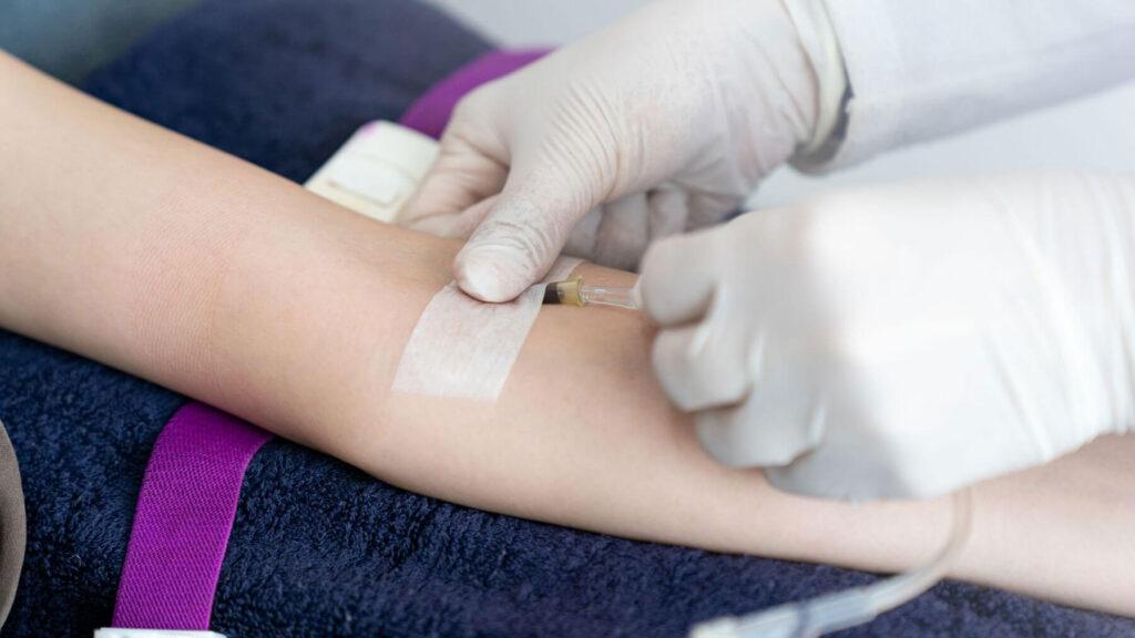 IV-Sedation-Dentistry-in-Carlsbad