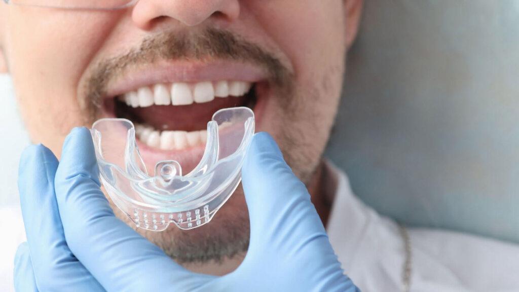 Mouth Guard for Sleep Apnea in Carlsbad, CA