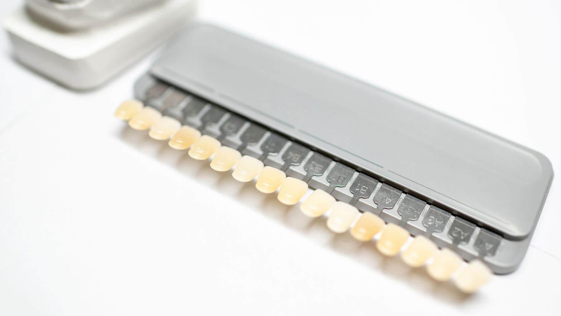 Scale-of-Veneers