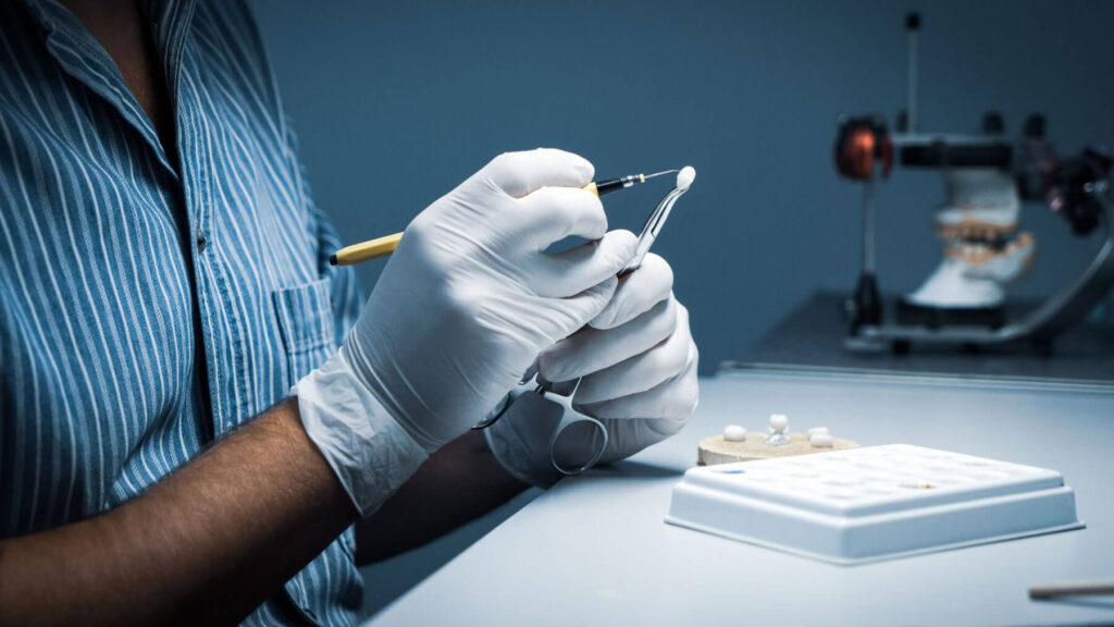 How Is a Dental Crown Placed? What to Expect Step by Step