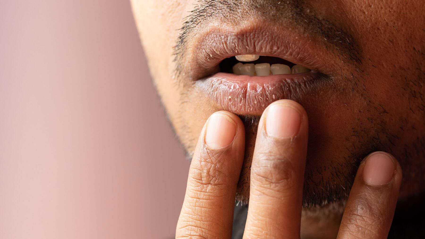 Dry Mouth For Teeth