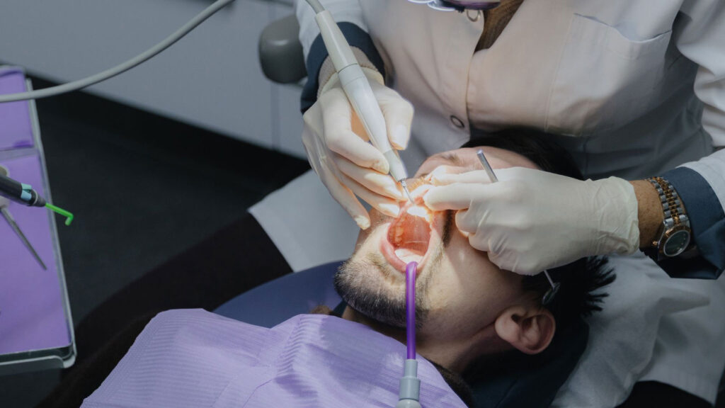 Professional Fluoride Treatment