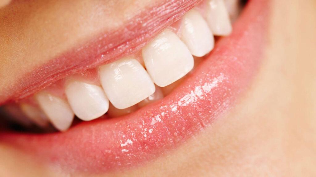 Healthy Smile After Teeth removal