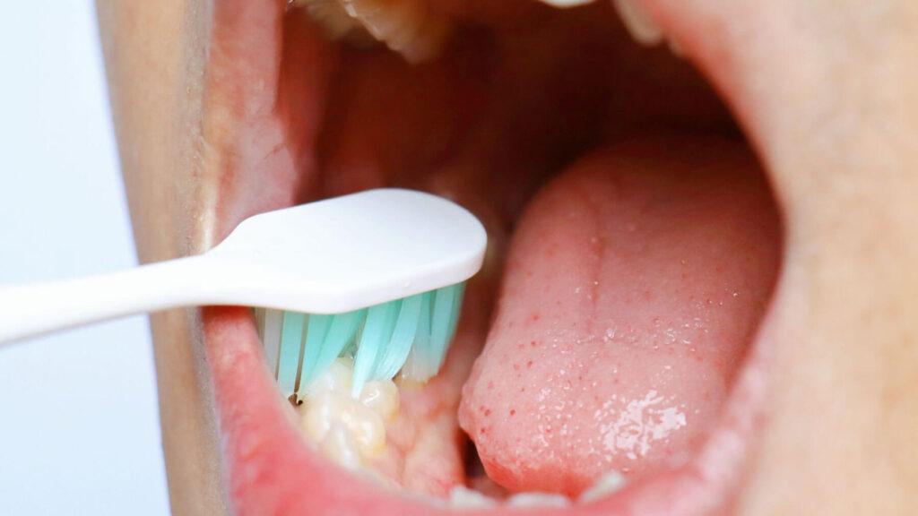 Prevent Cavities After Breakfast with Brush