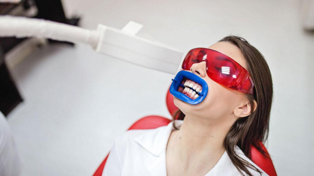 Professional Whitening - Smiles For Health