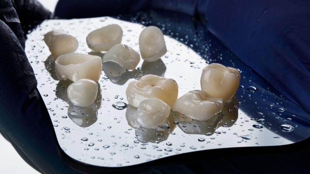 How to Rid a Sharp Broken Crown of Tooth