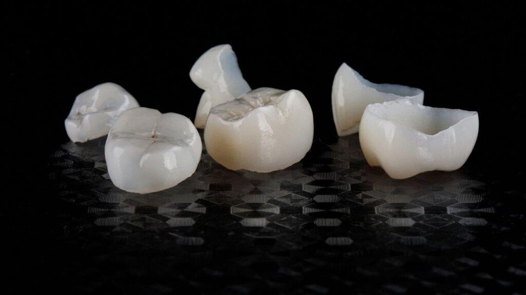 What Does a Dental Crown Do?