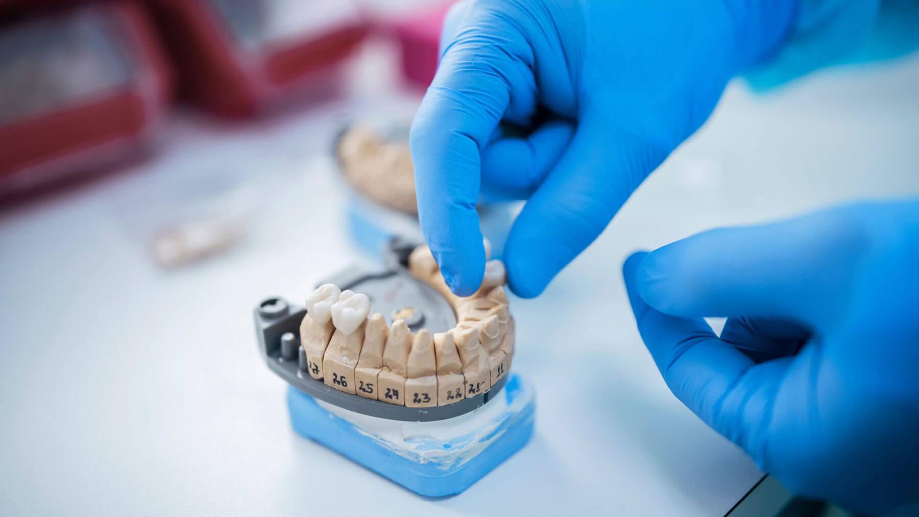 Dentist-Realize-a-Dental-Crowns