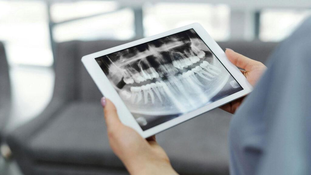 Dentist-in-Carlsbad - Smiles-For-Health