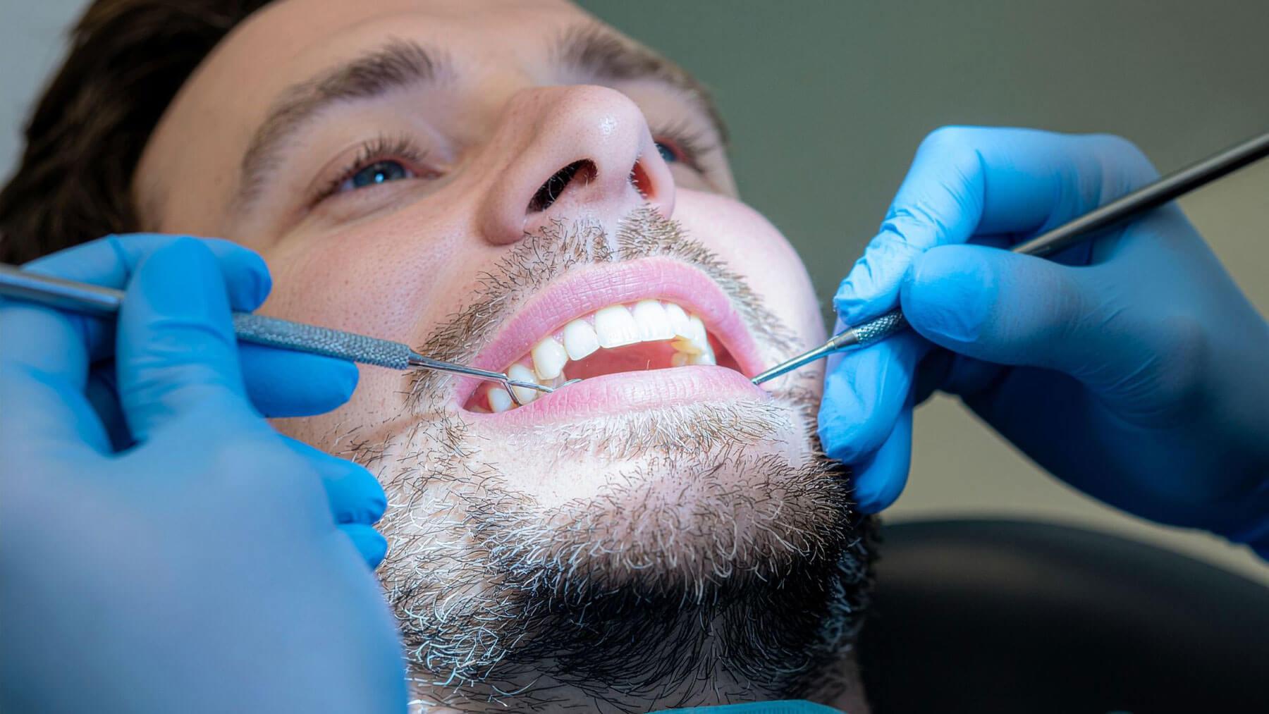 When A Root Canal Might Be Needed After A Filling