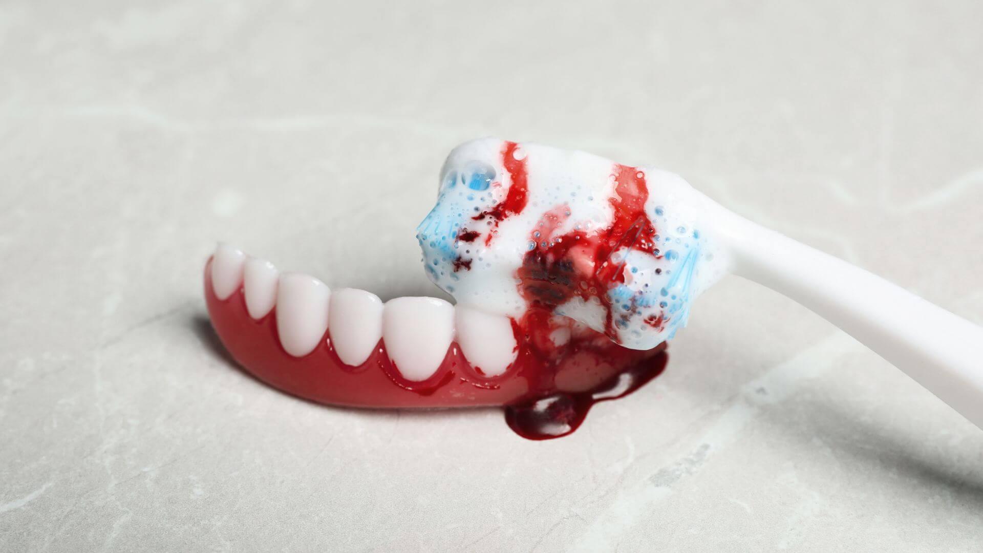 How Long to Keep Gauze In After Tooth Extraction