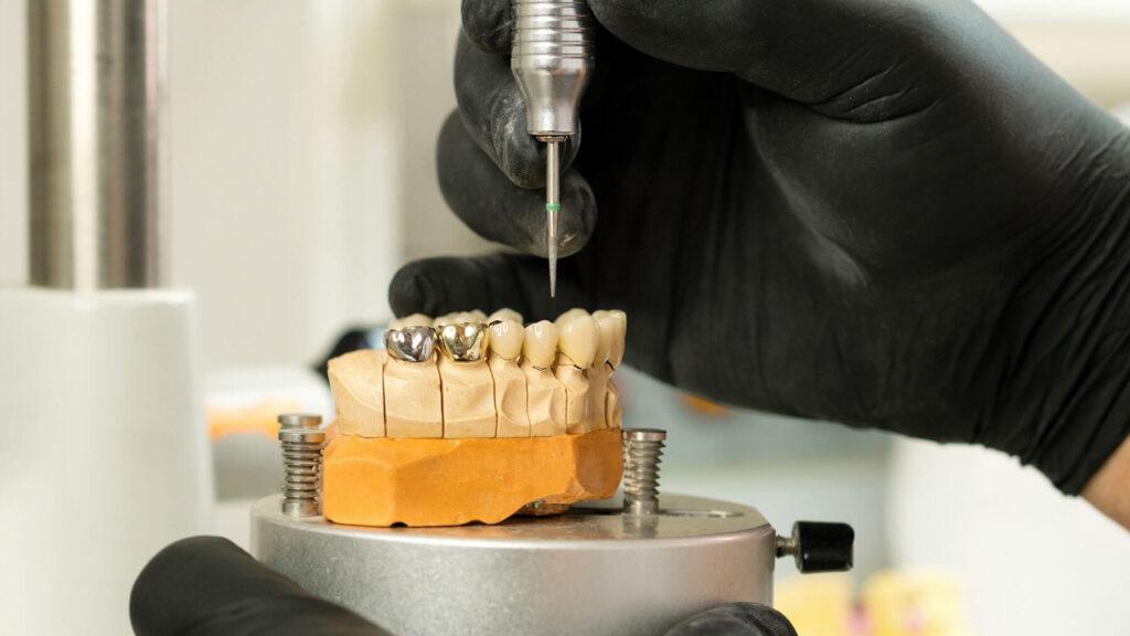 Long-Term Fixes For A Broken Crown