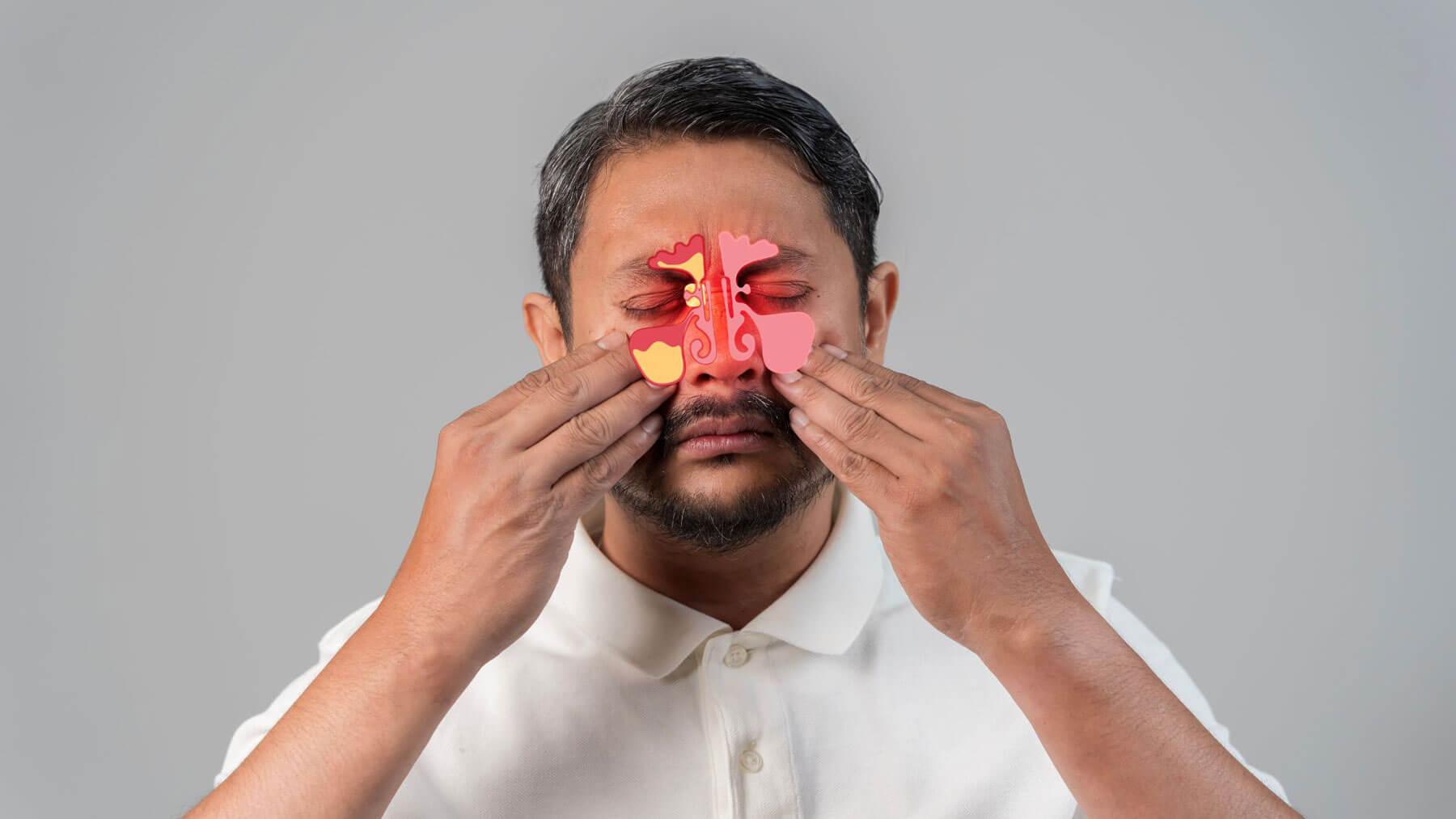 How to Relieve Tooth Pain from Sinus Pressure​