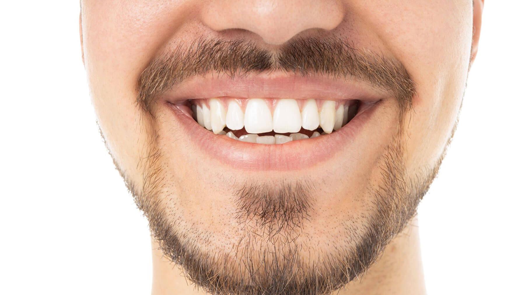 Healthy gums with Smiles For Health in Carlsbad