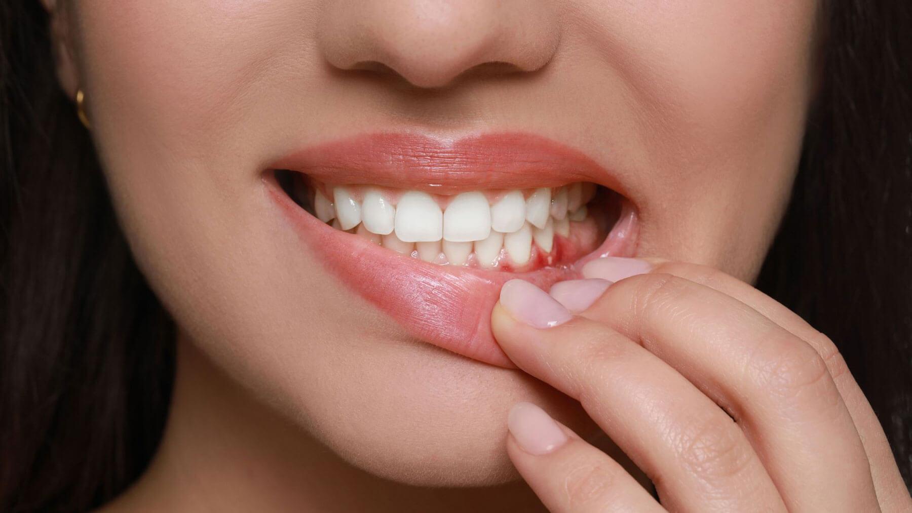 Alcohol After Tooth Extraction: What Can Happen If You Drink Too Soon