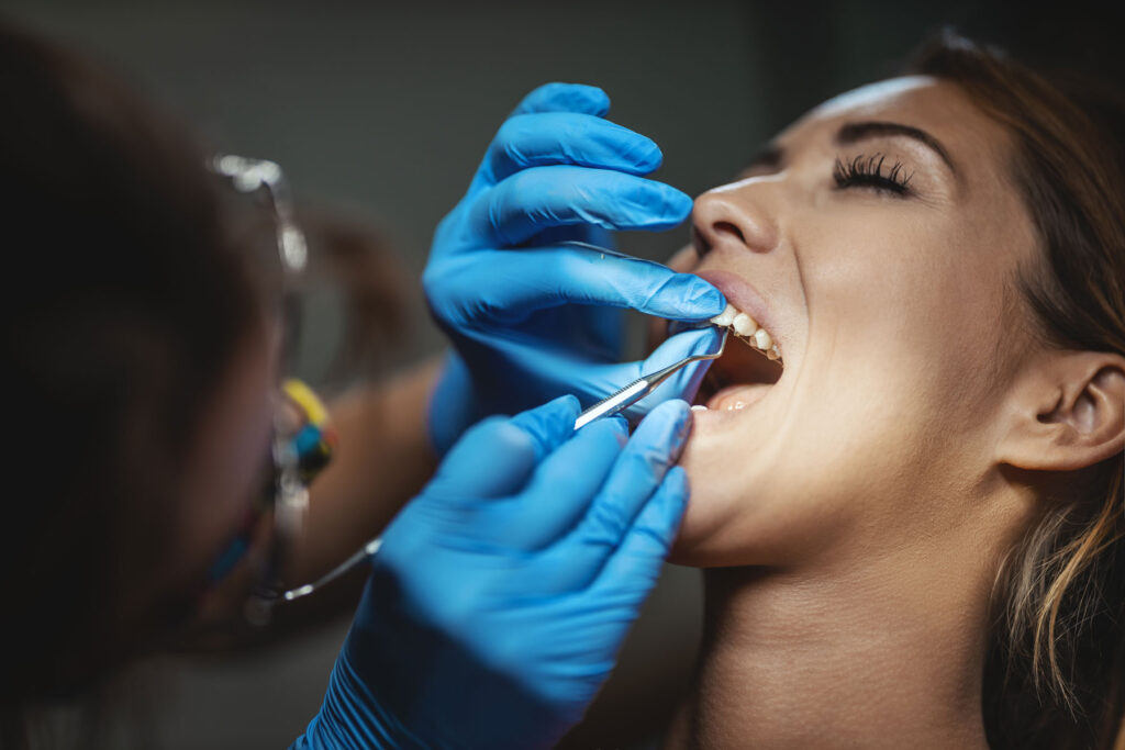 Tooth-Extraction-Dentist-Carlsbad-Smiles-For-Health