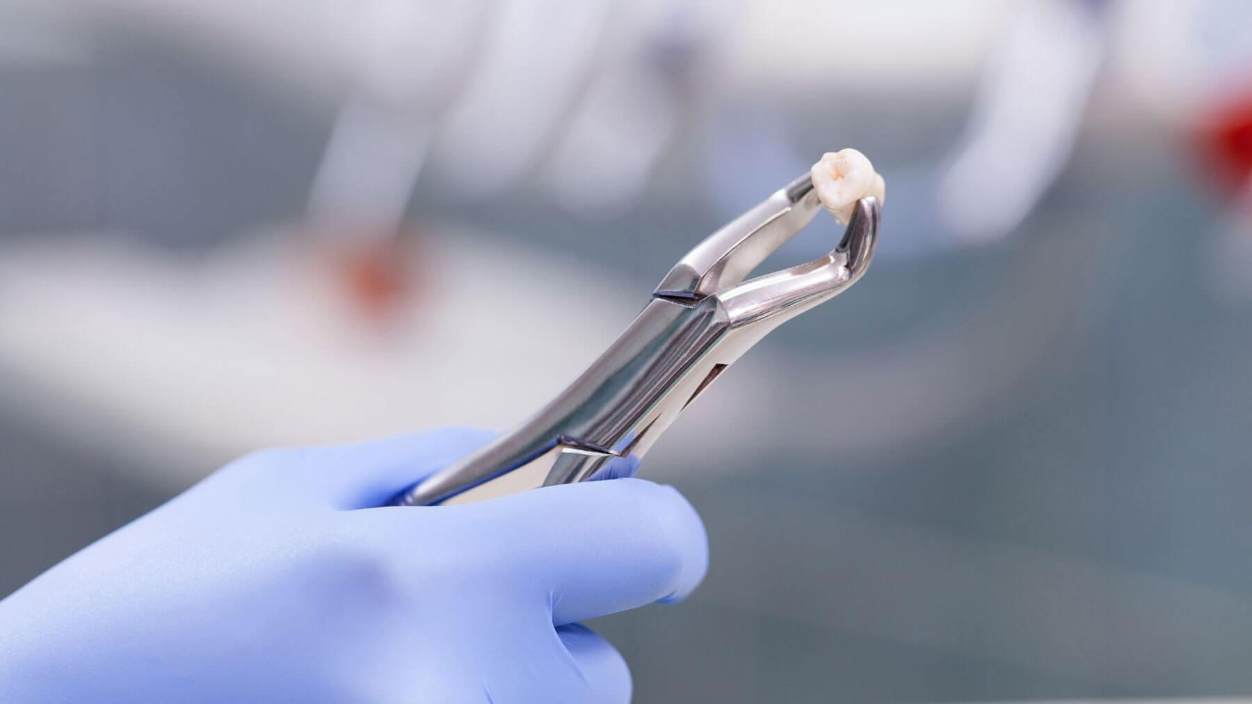 What Treatments Stop A Tooth Infection From Spreading