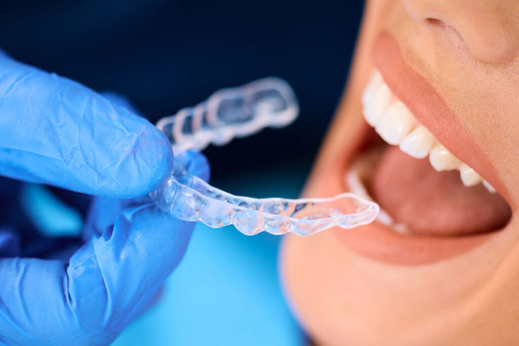 Invisalign treatment in Carlsbad