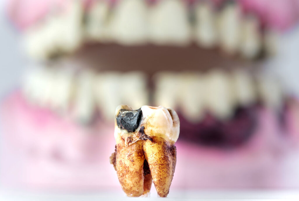 Decade Tooth Smiles For Health