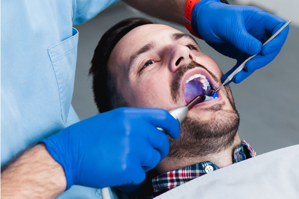 Sealant In Adult for Dental Cavity